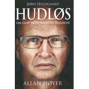 Hudls - af Allan Hyer